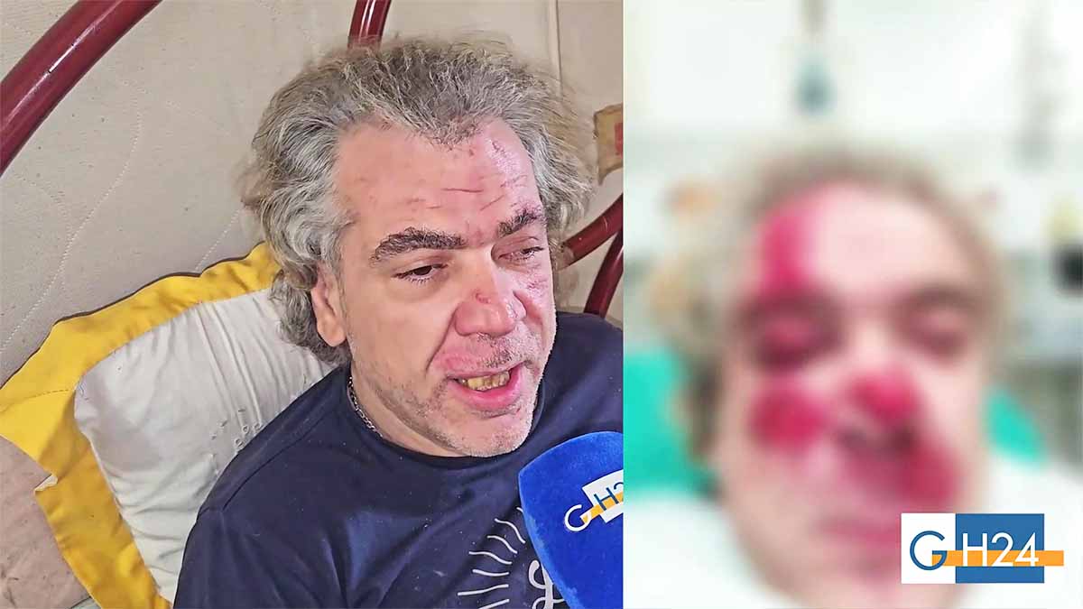 disabile-ischitella